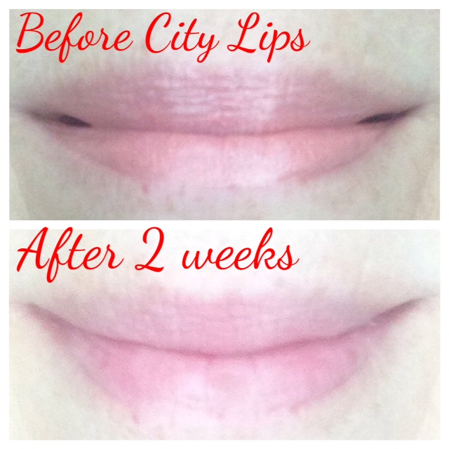 City Lips plumping before and after