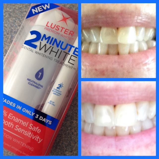 Luster 2 Minute White teeth whitening kit & my before & after photos neversaydiebeauty.com @redAllison
