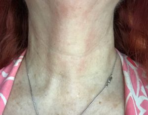 my neck wearing StriVectin Tightening Neck Serum Roller and TL Advanced Tightening Light Neck Cream, neversaydiebeauty.com