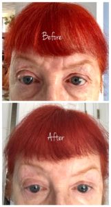 Incredible By Nature Eye Gel before & after, neversaydiebeauty.com