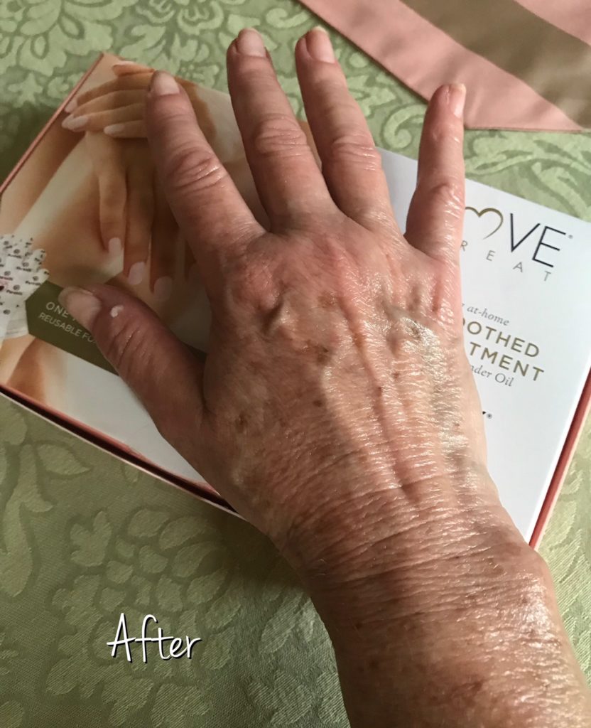 my hand after using Parasilk gLOVE hand treatment looking plumper and more hydrated, neversaydiebeauty.com