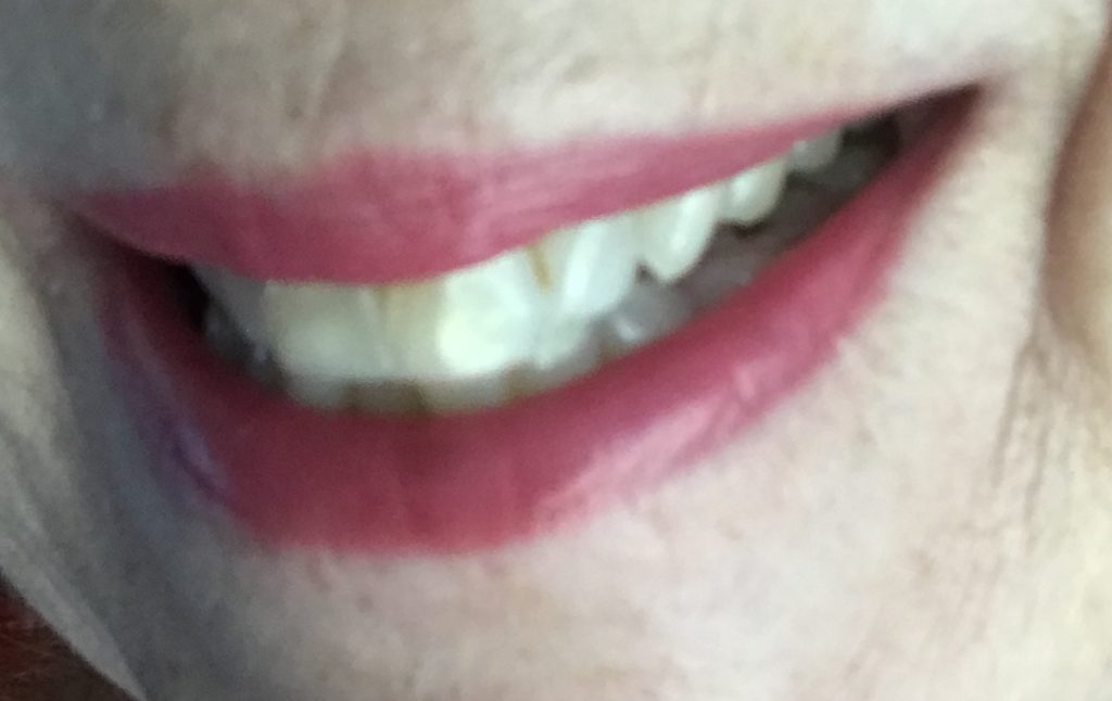 my "before" photo of my teeth, before I started using Luster AM/PM Toothpaste, neversaydiebeauty.com