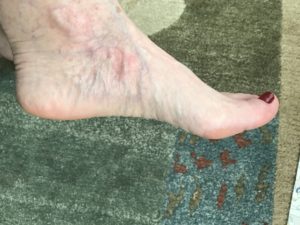 my smooth foot after using Legendary Apothecary Smooth Feet, neversaydiebeauty.com