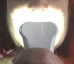 me using the Luster Premium White blue light device to lighten my teeth, neversaydiebeauty.com