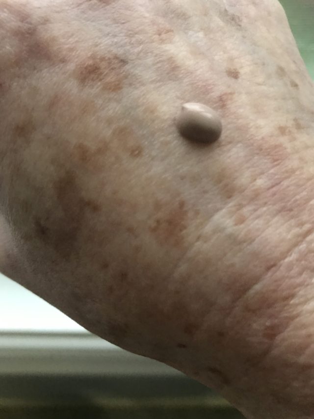 a pinkish taupe drop of Graydon Face Glow on the back of my hand that has lots of dark spots from sun damage
