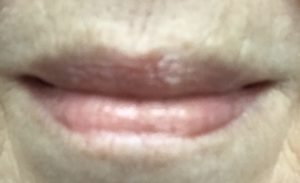 my lips wearing Theraderm Anti-aging Lip Complex