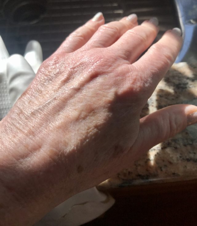 the skin on the back of my hand